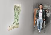  Ballacks „WM-Gips“ 
